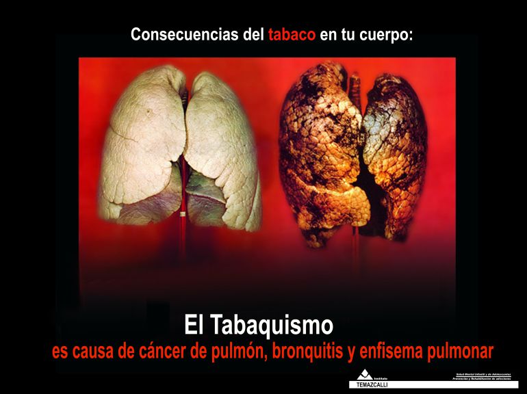 El tabaco, la principal adicción de los jóvenes Internacional