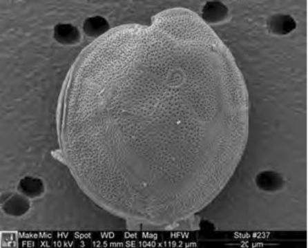 Gambierdiscus, la microalga productora de la toxina que provoca la ciguatera. Gambierdiscus, la microalga productora de la toxina que provoca la ciguatera.