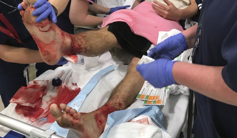 El adolescente Sam Kanizay recibe asistencia médica en un hospital tras, según afirmó, recibir mordiscos de "diminutas criaturas marinas" en la bahía local, en Melbourne (Australia). El adolescente Sam Kanizay recibe asistencia médica en un hospital tras, según afirmó, recibir mordiscos de "diminutas criaturas marinas" en la bahía local, en Melbourne (Australia).