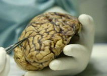 Identificada una nueva molécula multipotente para tratar el Alzhéimer