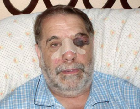Imagen de González tras ser agredido publicada por El País en 2010 Imagen de González tras ser agredido publicada por El País en 2010