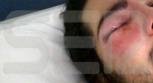 El joven ha perdido la visión en el ojo derecho El joven ha perdido la visión en el ojo derecho