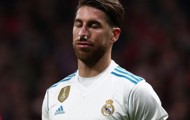 Sergio Ramos, después del golpe que recibió de Lucas Hernández. Sergio Ramos, después del golpe que recibió de Lucas Hernández.