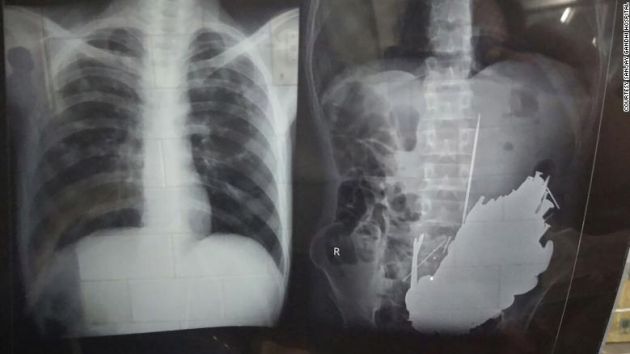 Radiografías del paciente