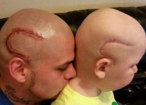 La despedida del padre que se tatuó una cicatriz como la de su hijo en la cabeza