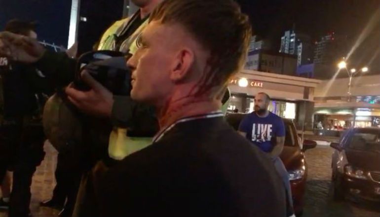 Imagen de uno de los hinchas del Liverpool que han sido agredidos en Kiev Imagen de uno de los hinchas del Liverpool que han sido agredidos en Kiev