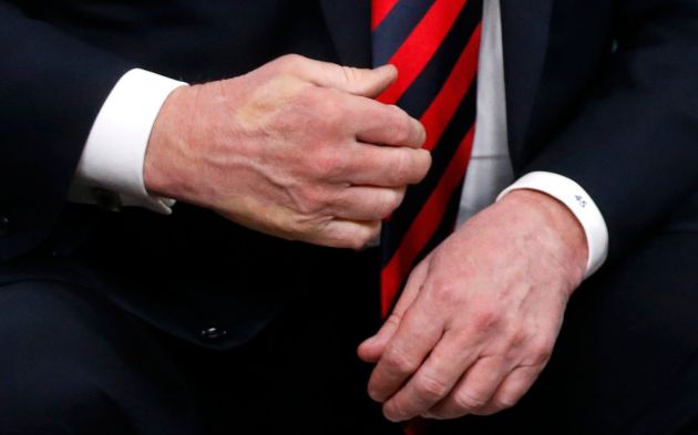 La mano de Trump tras el saludo con Macron. La mano de Trump tras el saludo con Macron.