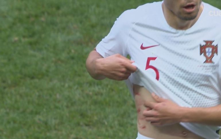 Guerreiro enseña las marcas que le provocó Amrabat. Guerreiro enseña las marcas que le provocó Amrabat.