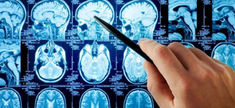Los virus podrían influir en el desarrollo de enfermedades mentales Los virus podrían influir en el desarrollo de enfermedades mentales
