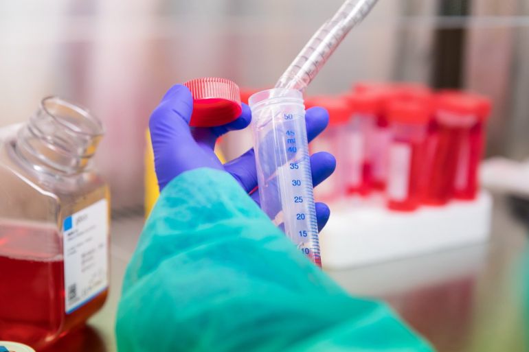 El trastorno alcohólico fetal afecta al 50% de menores de Rusia y Ucrania adoptados en Cataluña El trastorno alcohólico fetal afecta al 50% de menores de Rusia y Ucrania adoptados en Cataluña