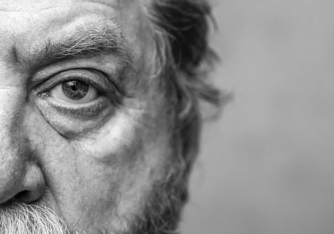 Retinosis pigmentaria: cuando la oscuridad provoca ceguera Retinosis pigmentaria: cuando la oscuridad provoca ceguera