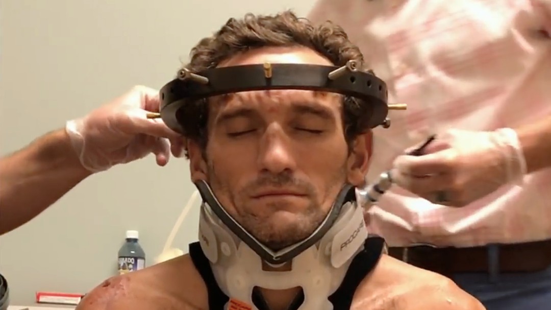 Tim Don: Si me rompiera el cuello de nuevo no me podría el halo. No puedo describir lo doloroso que es