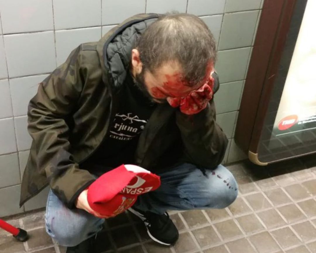 Agreden a un hombre con una bandera de España en el Metro de Barcelona Agreden a un hombre con una bandera de España en el Metro de Barcelona