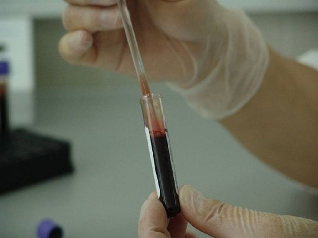 Salud descarta la meningitis como causa de la muerte de un niño en Aznalcóllar Salud descarta la meningitis como causa de la muerte de un niño en Aznalcóllar