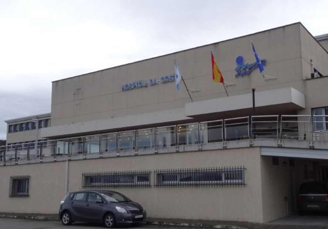 CIG Saúde acusa al Sergas "de cerrar 60 camas en el Hospital de la Costa por no querer invertir en personal"