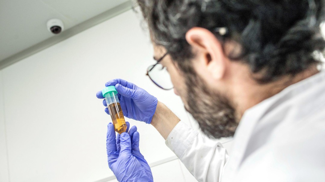 El Estado es quien más invierte en I+D sanitario, pero no hay retorno social