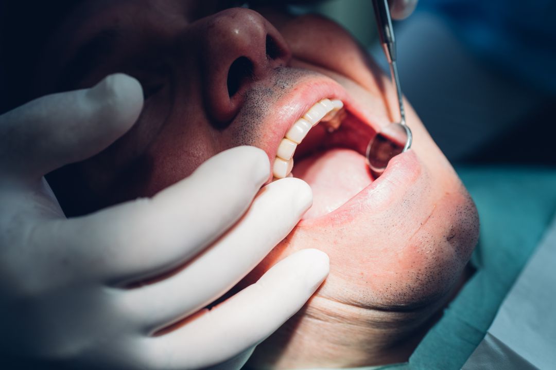 Dientes blancos, pero ¿a qué precio? Dientes blancos, pero ¿a qué precio?