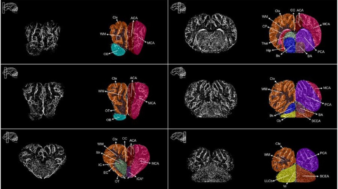 Un grupo de investigadores restauran algunas funciones en el cerebro de un cerdo horas después de la muerte