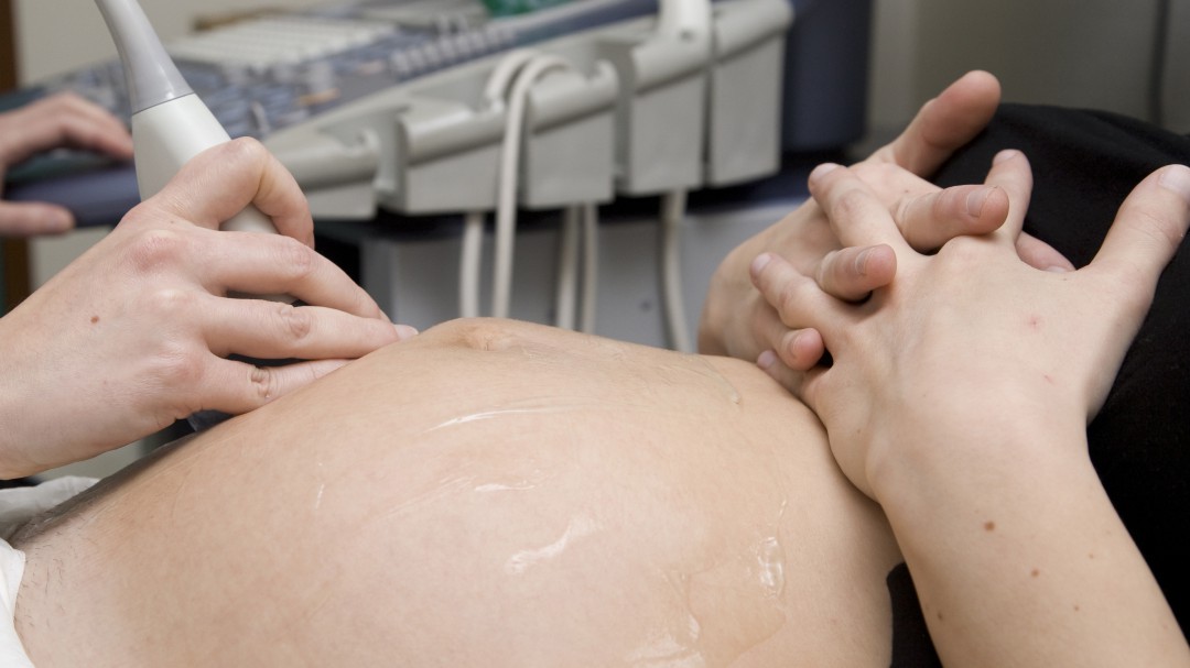 Menos amniocentesis, menos riesgos para la madre y el bebé