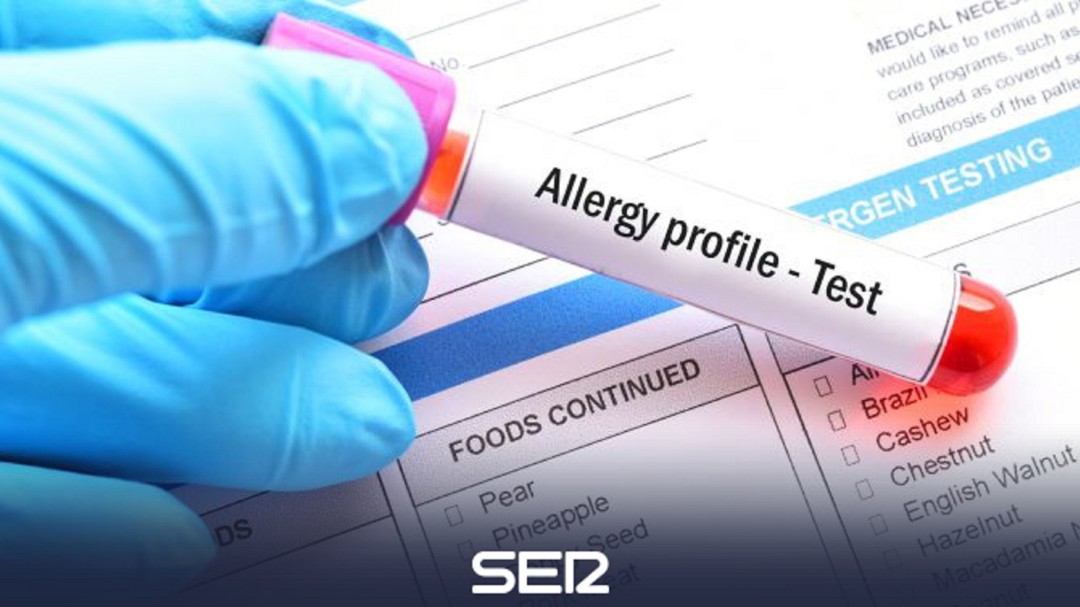 Balears dispone desde 2014 de un registro de 2.000 alumnos con alergias, asma, diabetes y epilepsia