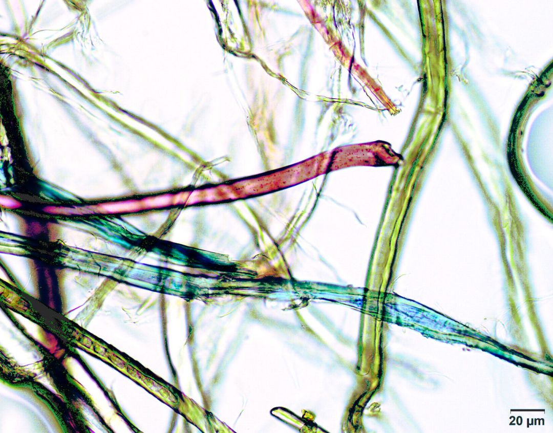 Imagen de fibras de microplástico detectadas en el interior del cuerpo humano.
Imagen de fibras de microplástico detectadas en el interior del cuerpo humano.