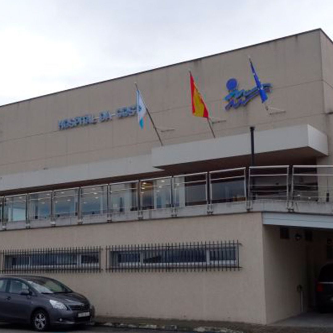 Dos médicos de Burela deberán de indemnizar con 50 mil euros a una paciente a la que, tras una operación, dejaron una gasa en el abdómen Dos médicos de Burela deberán de indemnizar con 50 mil euros a una paciente a la que, tras una operación, dejaron una gasa en el abdómen