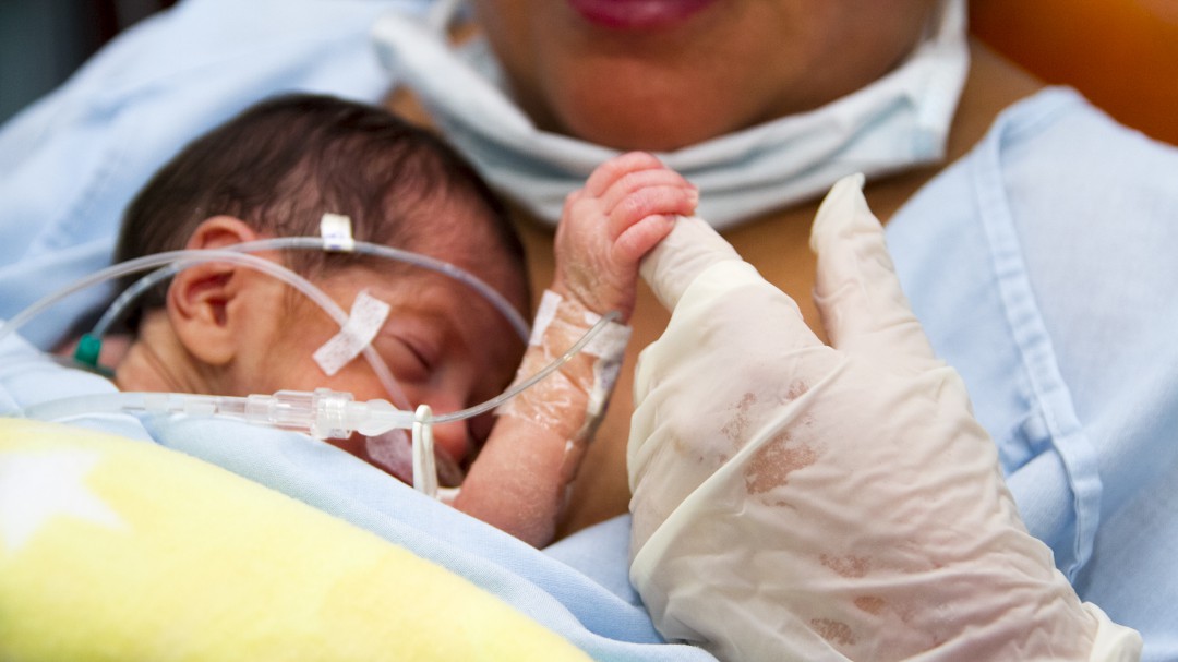¿Por qué el parto humano es tan doloroso?