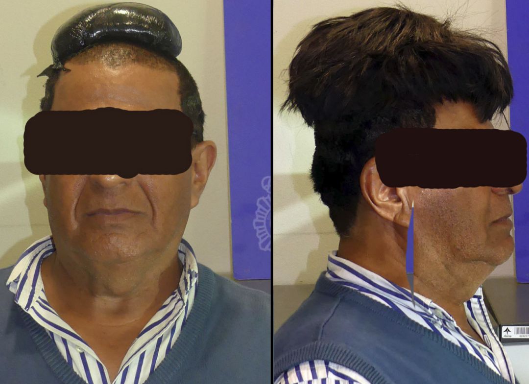 Detenido un hombre que ocultaba medio kilo de cocaína en su peluquín Detenido un hombre que ocultaba medio kilo de cocaína en su peluquín
