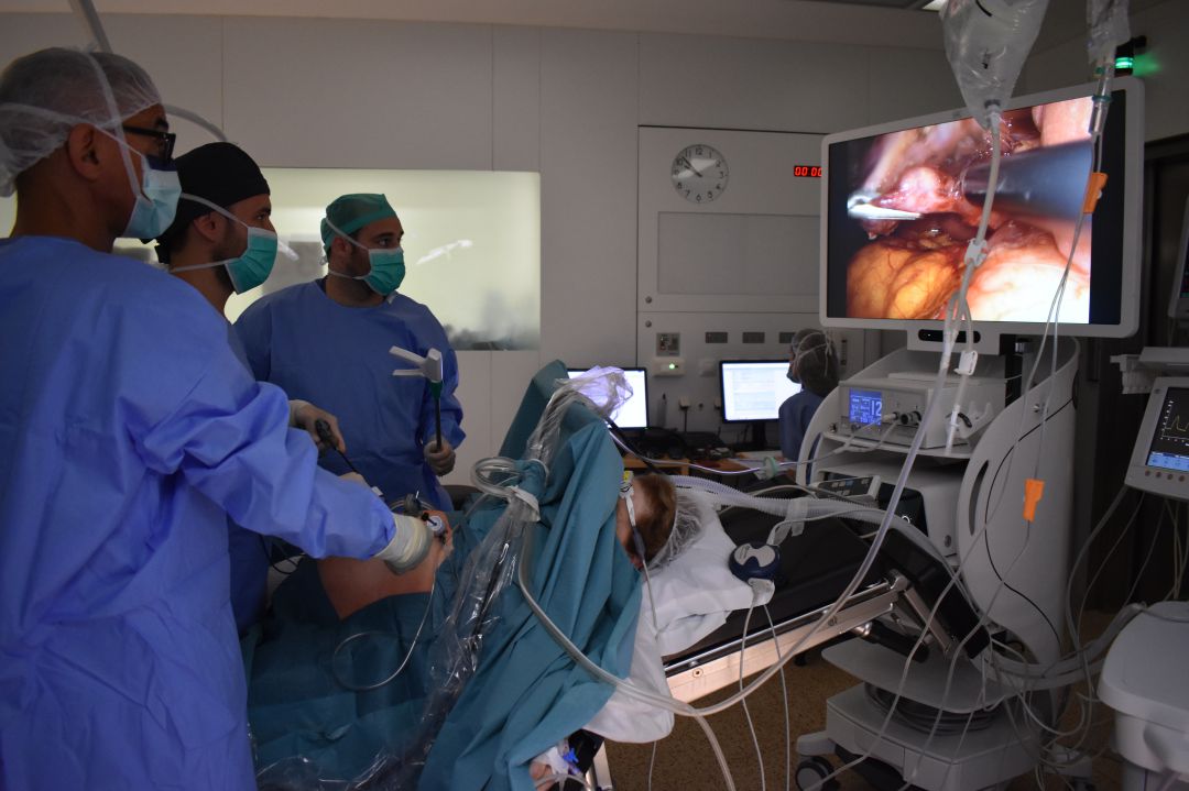 Treure's la vesícula biliar ja no suposarà quedar-se ingressat a l'hospital: Treure's la vesícula biliar sense ingressar a l'hospital Treure's la vesícula biliar ja no suposarà quedar-se ingressat a l'hospital: Treure's la vesícula biliar sense ingressar a l'hospital