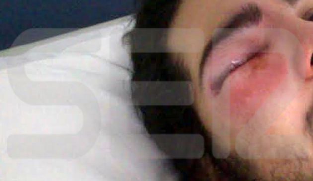 Imagen de las lesiones del joven poco después del 22-M Imagen de las lesiones del joven poco después del 22-M