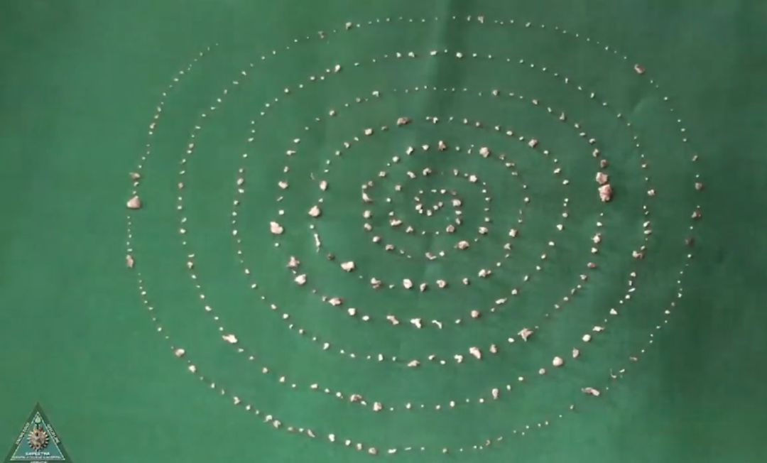 Los cirujanos pudieron extraer un total de 526 dientes de la boca del niño. Los cirujanos pudieron extraer un total de 526 dientes de la boca del niño.