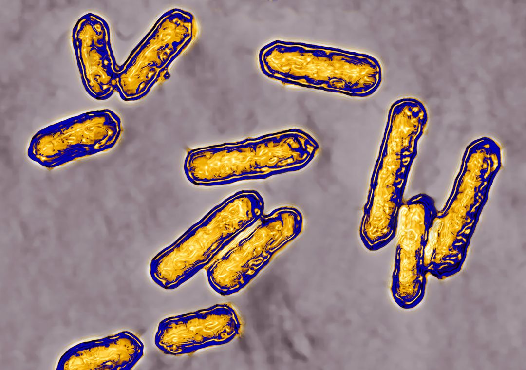 Bacteria 'listeria' a vista de microscopio. Bacteria 'listeria' a vista de microscopio.