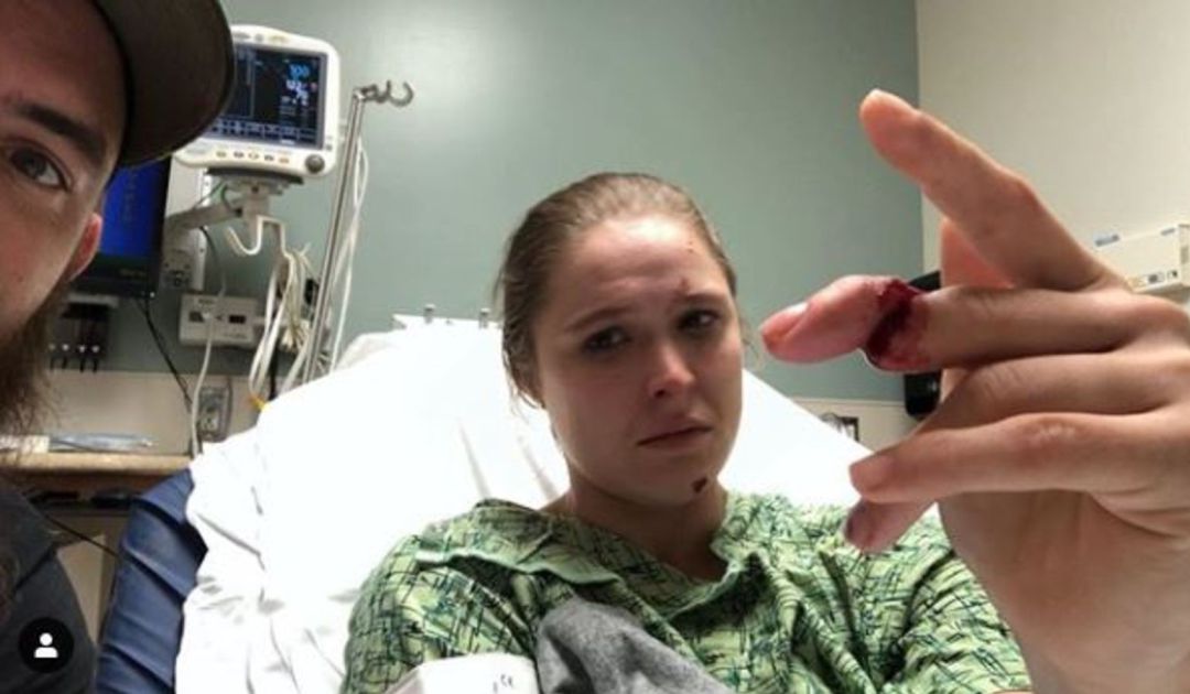 Ronda Rousey sufre la amputación de parte de un dedo por un accidente mientras grababa una serie Ronda Rousey sufre la amputación de parte de un dedo por un accidente mientras grababa una serie