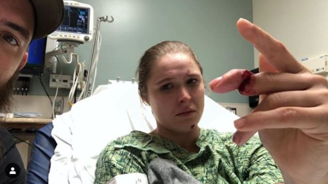Ronda Rousey pierde parte de un dedo por un accidente