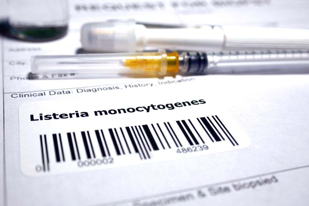 ¿Qué ha fallado en la crisis de la carne con listeriosis? ¿Qué ha fallado en la crisis de la carne con listeriosis?