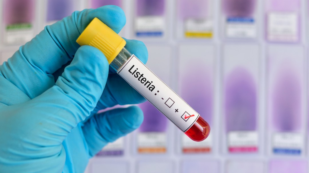 "La gestión de la listeriosis ha tenido muchos fallos"