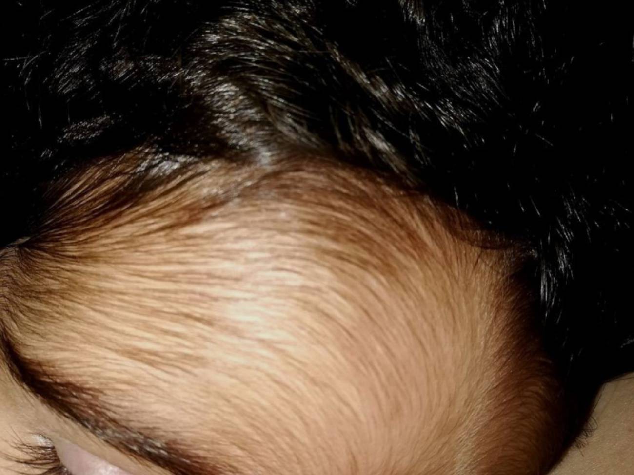 Mi Hija Padece El Sindrome Del Hombre Lobo Por Culpa Del Medicamento Radio Santander Cadena Ser La comunidad de compra y venta online más grande de américa latina. cadena ser