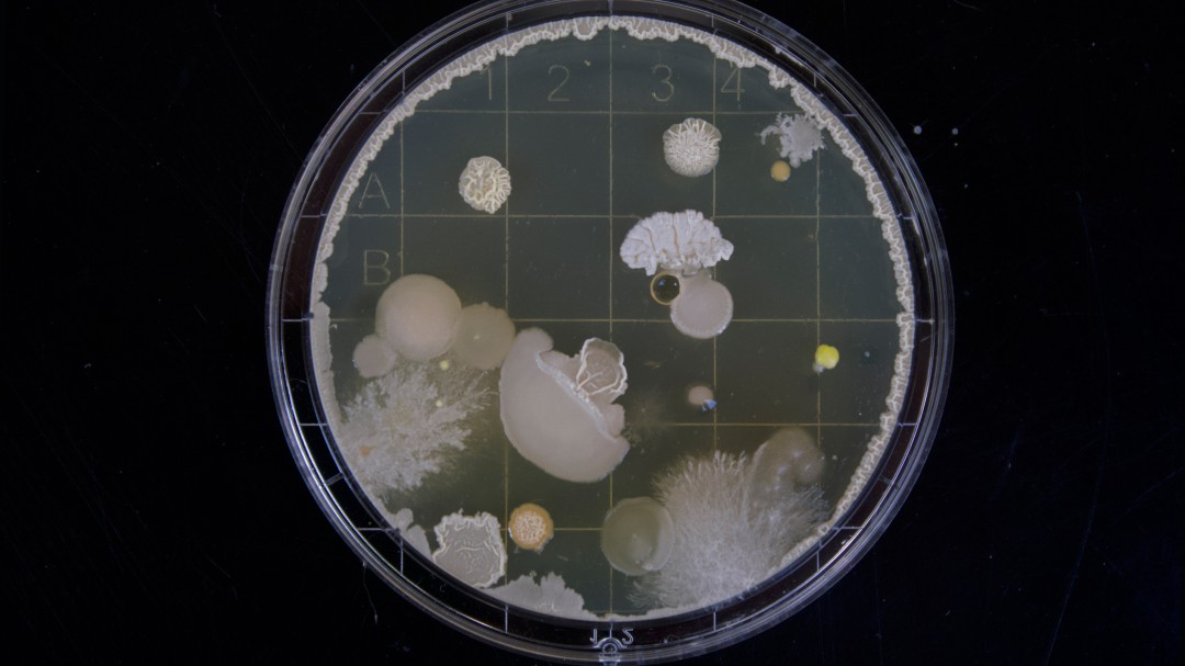 Las bacterias, ¿aliadas de los runners para correr más?