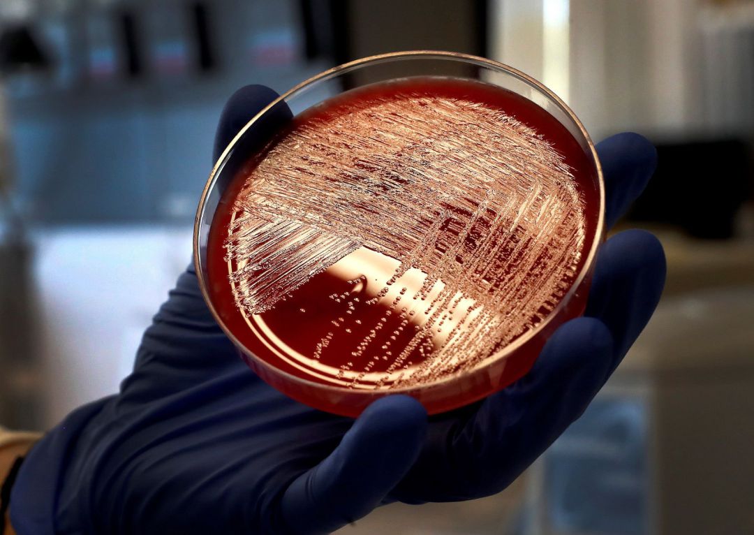 Confirmado un segundo caso de listeria Confirmado un segundo caso de listeria