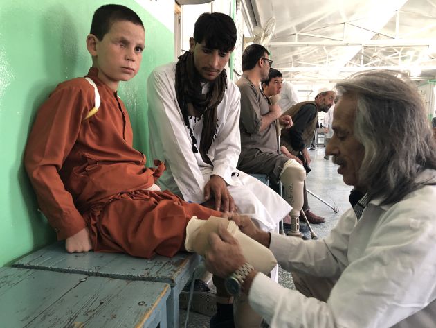 El fisioterapeuta Eshan Nasimi coloca la protesis a Farshid ante la mirada de su hermano Mohammad Qabir. El fisioterapeuta Eshan Nasimi coloca la protesis a Farshid ante la mirada de su hermano Mohammad Qabir.