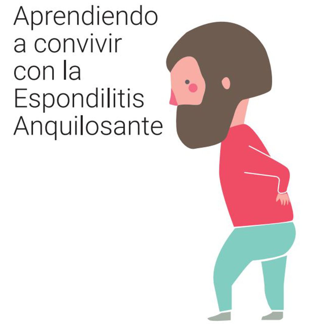 Cartel informativo de Espondiloartritis Cartel informativo de Espondiloartritis
