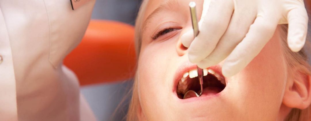 Baja la caries en niños de 7 a 14 años pero aumenta en menores de 7 años Baja la caries en niños de 7 a 14 años pero aumenta en menores de 7 años