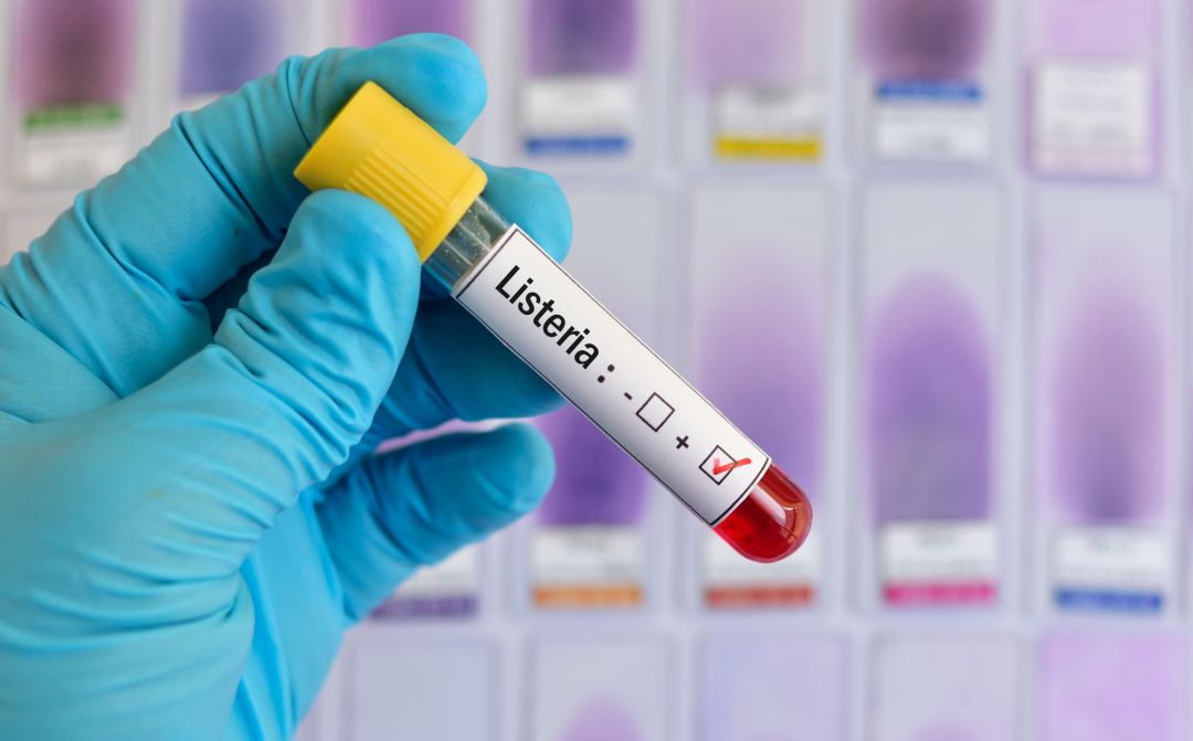 SER Consumidor: Los responsables del brote de listeriosis SER Consumidor: Los responsables del brote de listeriosis