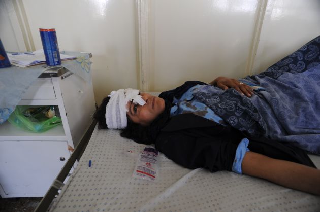 Una mujer herida en un atentado con coche bomba en Kabul Una mujer herida en un atentado con coche bomba en Kabul