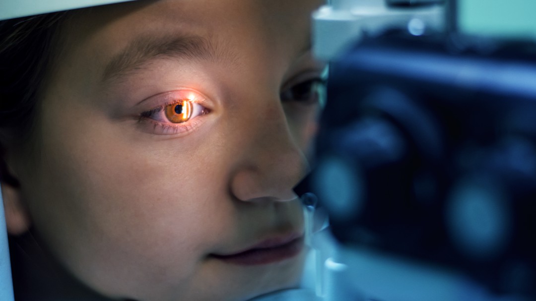 Prevenir problemas de retina