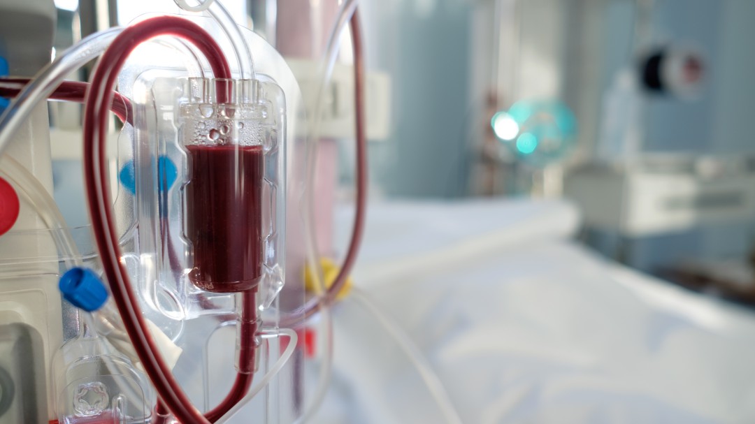 Sanidad insiste en que sí paga los traslados de los enfermos dializados desplazados