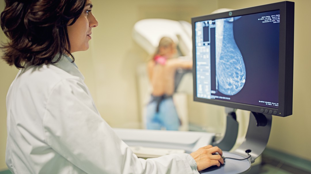 135.000 madrileñas a la espera de mamografías por la paralización del programa de detección precoz del cáncer