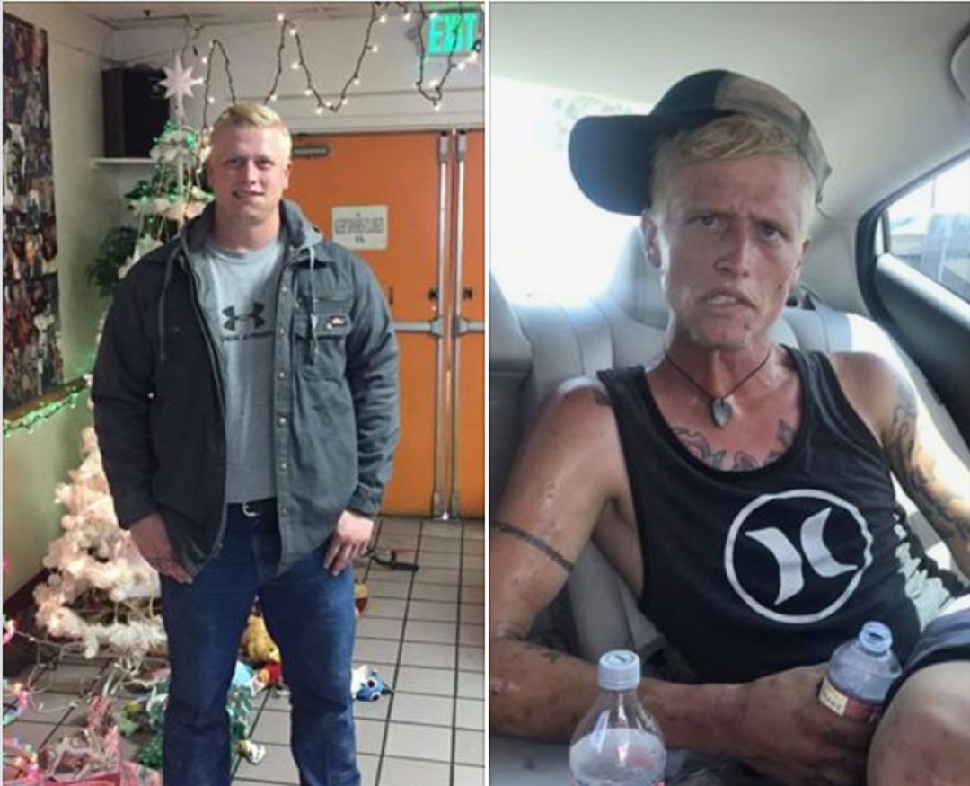 El antes y después de la adicción a la heroína El antes y después de la adicción a la heroína