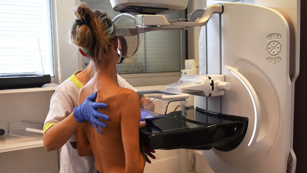 Mamografías: cuándo empezar a hacerlas y cada cuánto tiempo