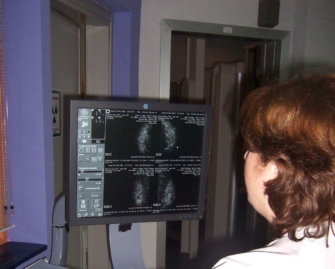 Un millón 200 mil andaluzas han pasado por el programa de detección precoz del cáncer de mama Un millón 200 mil andaluzas han pasado por el programa de detección precoz del cáncer de mama